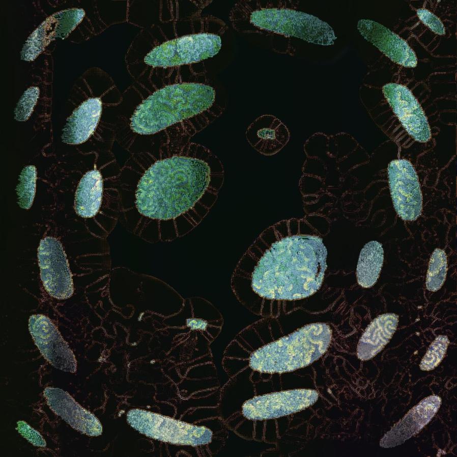 A digital iamge where organic green sahpes resembling bacteria float in black space