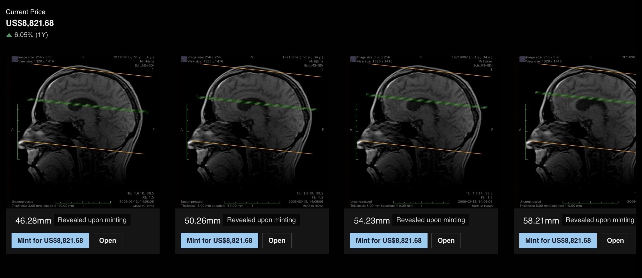 A screenshot of a website page showing a row of four brain scans